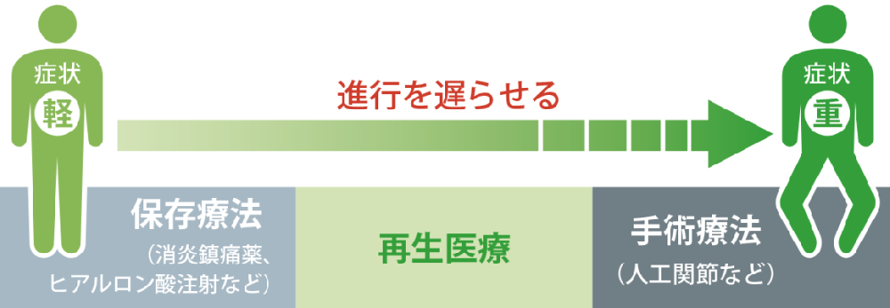 膝盖痛不再怕,告别关节置换,不动刀就能修复!