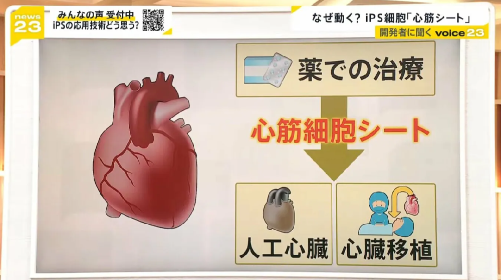 日本iPS细胞重大突破,心脏修复迈入全新纪元!