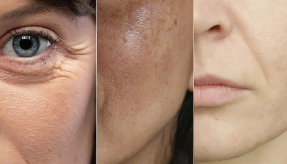 抗衰新宠，纤维芽细胞