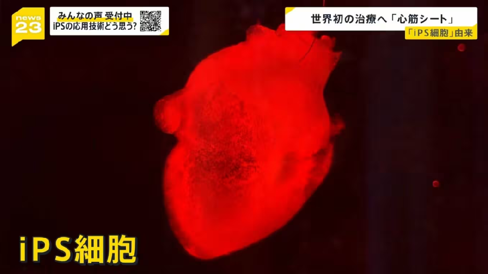 体检指标正常，为什么还会心梗？揭秘血脂报告里看不见的“隐形杀手”